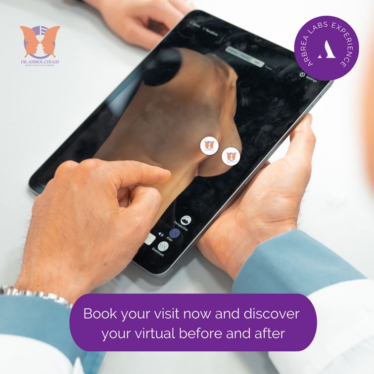 Breast Implants Consultation Step 3