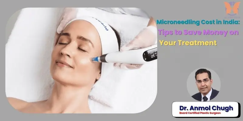 Microneedling Cost in India: Tips to Save Money on Your Treatment