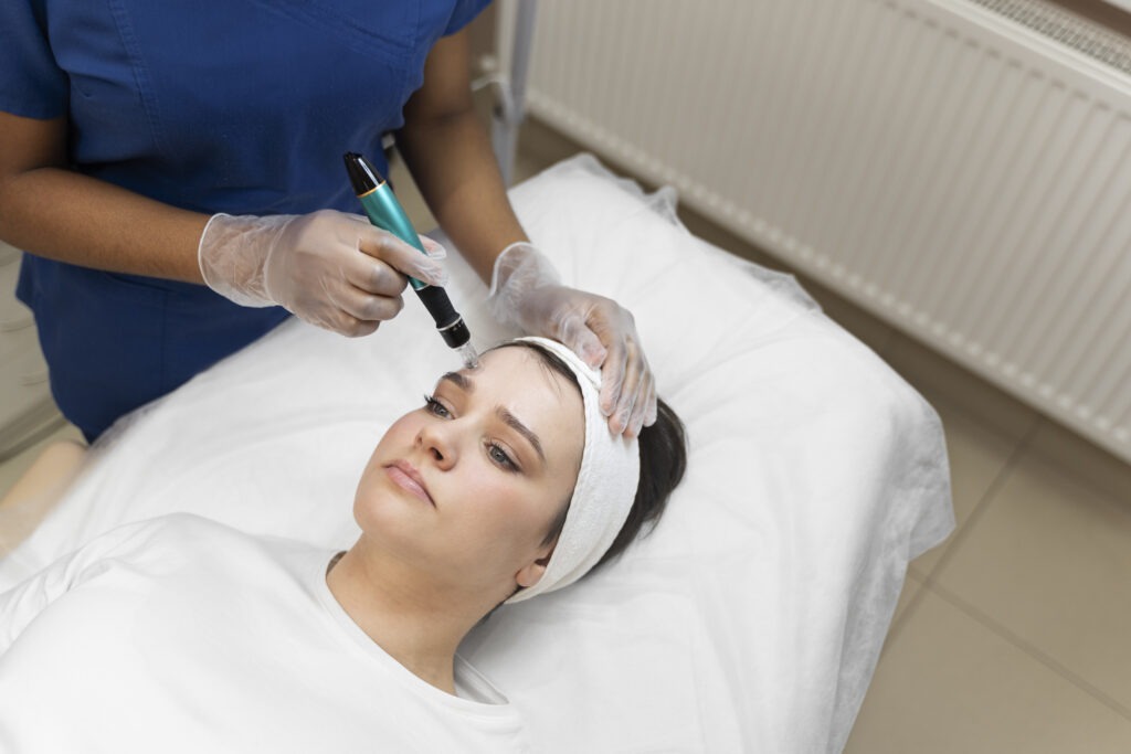 micro needling beauty treatment
